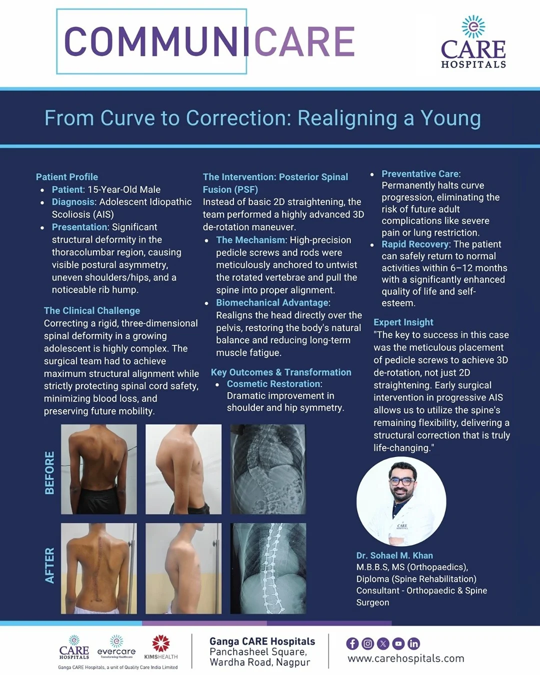 From Curve to Correction: Realigning a Young